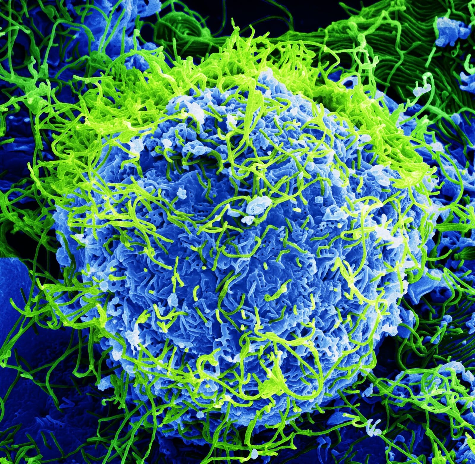 "Beautiful....But Deadly": Colorized scanning electron micrograph of Ebola virus particles (green) found both as extracellular particles and budding particles from a chronically-in